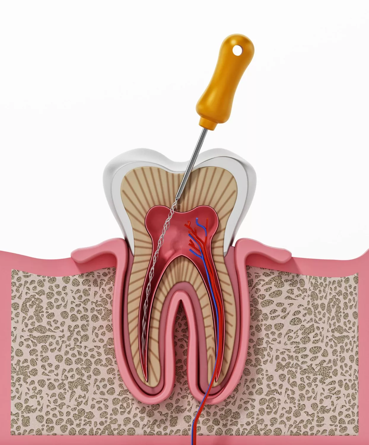 Dental Implants thumbnail