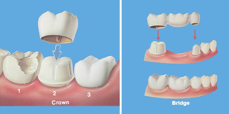 Laser Dentistry thumbnail